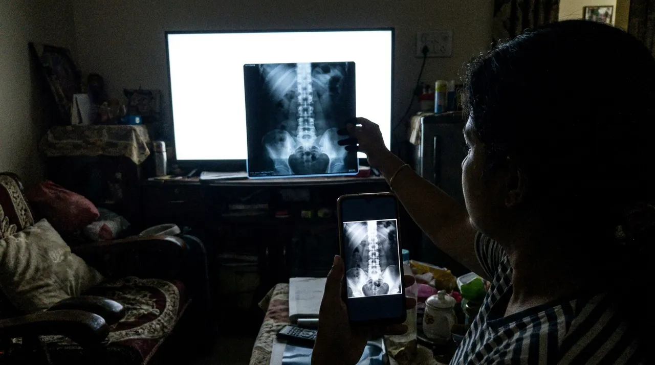 अँधेरे कमरे में सफ़ेद TV के सामने रखी X-ray की फ़ोन से फ़ोटो लेते हुए, फ़ोन में साफ़ तस्वीर